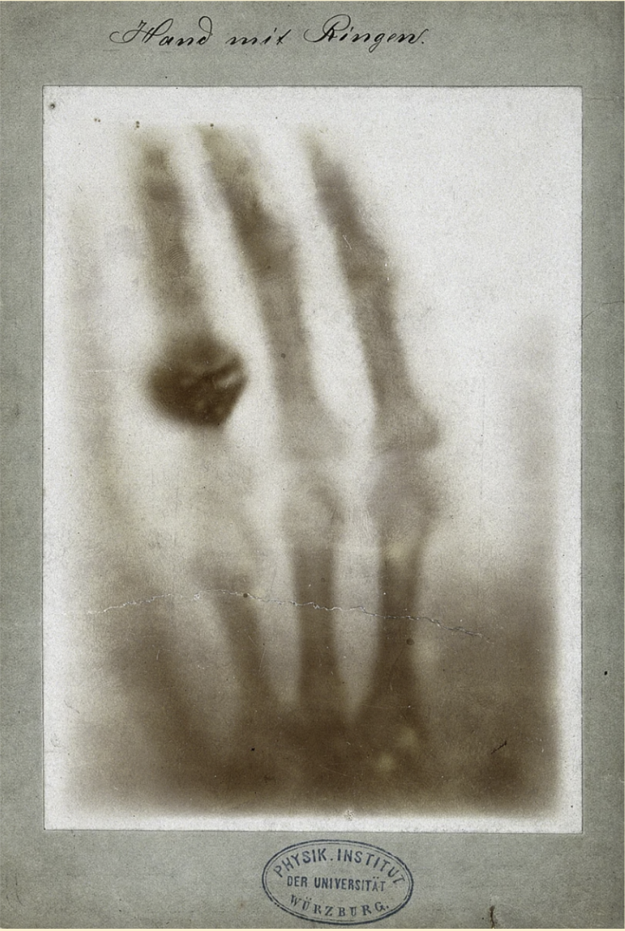 Wilhelm Conrad Röntgen X-ray of his wife's hand