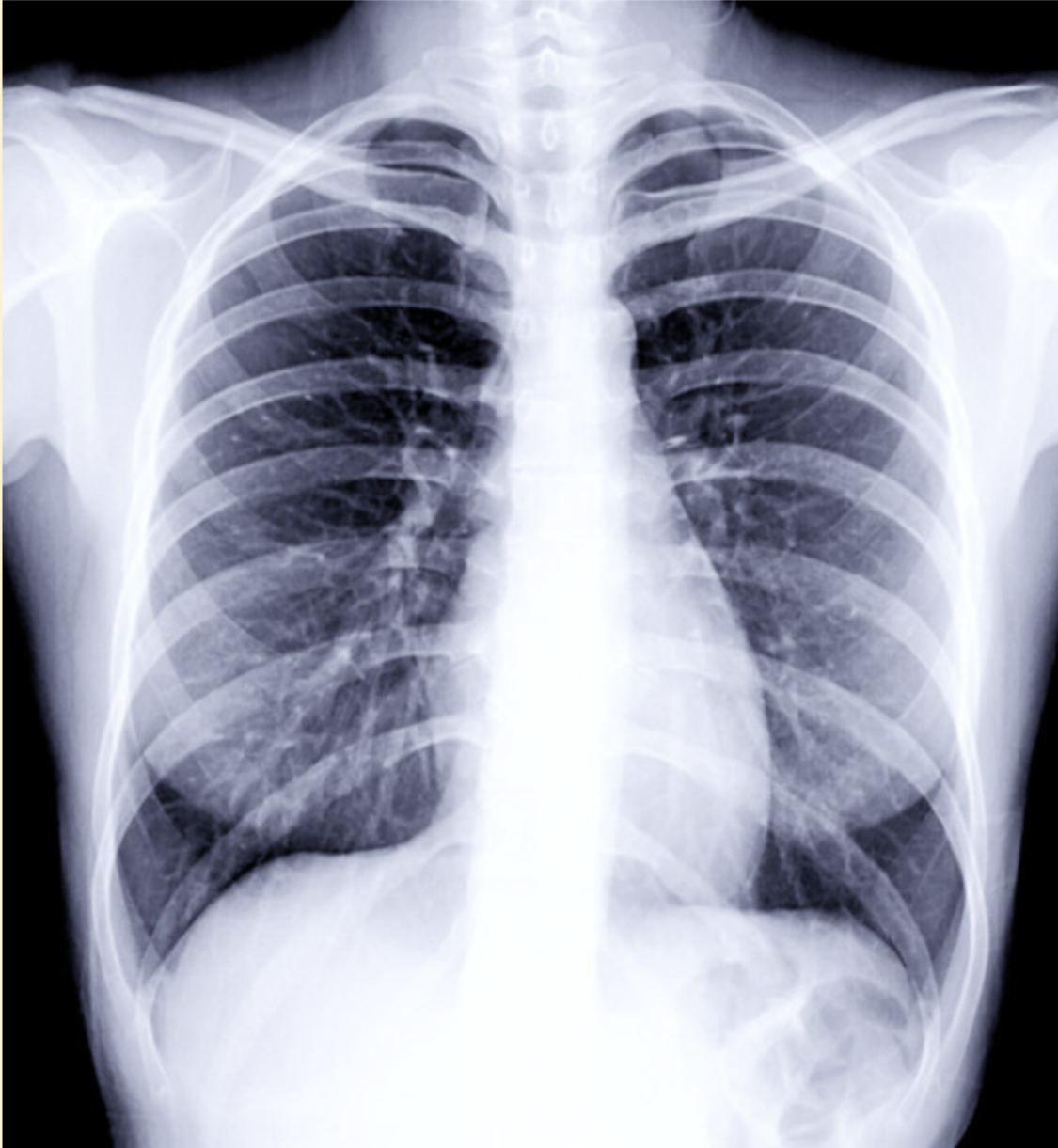 X-ray image of human ribcage